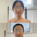 (주)케어핏 이미지