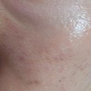 티업의원 이미지