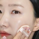 리쥬란힐러 후 눈밑 아이리쥬란 가격 한달 후기