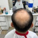 금성약국 | 60대 남성 맞춤 스포츠형 가발 후기 | 자연스럽고 멋스러운 남자가발 추천 (구의동 로사가발)