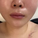 상지국밥 | 광주 에스테틱 끌리메광주점 작은얼굴관리 끝판왕!!