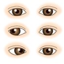 사시 strabismus의 종류 이미지