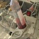 [VOA 영어뉴스] Blood Test May Revolutionize Cancer Treatment 이미지