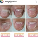 스타네일 이미지