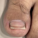 백림마취통증의학과의원 네이버블로그