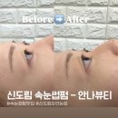 [신도림속눈썹펌 - 안나뷰티] 신도림 속눈썹펌 잘하는 곳, 신도림 테크노마트 속눈썹펌 후기