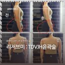 리저브미 | 용인에스테틱 리저브미 찐 후기 : 흥덕에스테틱 윤곽술 리뷰