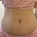 모아병원 | [내돈내산][인천 다이어트병원] 마른비만탈출기 (3) [인천 구월동 지방분해주사]