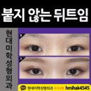 강남현대미학성형외과 Daum카페