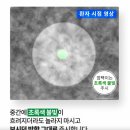 오천제일안과의원 | 눈에미소안과의원 스마일라식 당일수술 후기 /경도근시 /비용 가격/ 지인할인