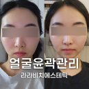 역북-14 | [용인] 역북 작은얼굴 리프팅 얼굴윤곽관리 내돈내산 후기
