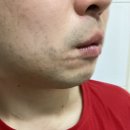 피부 자극없는 저자극 남자면도기 사용해본 후기