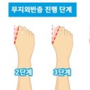 레푸스(수지구청점)