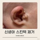 아이앤힐성형외과의원 | 71일차 스킨텍 수술, 현대해상 보험금 60만원 청구ㅣ아이앤힐 성형외과