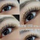퀭한 눈매에 희망이? 뷰티다인 방문기