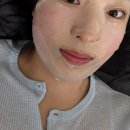 레드튠 | 청담피부과 튠페이스 블루로 이중턱 제거 후기, 효과, 가격