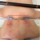 과천피부관리샵 '피부이야기' 등관리 50분 후기