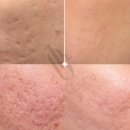 라인앤코한의원 이미지