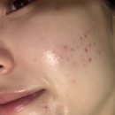 파주 운정 피부관리 추천 &#39;운정 다올뷰티&#39;