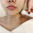 GS25 양정퀸즈점 | 연제구피부관리 후기｜레이저 후 보습·재생·진정 물방울관리, 물든 에스테틱