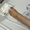 예손미용실 - 광주시 마루들길 246 | 엄지 발가락 사구체종양 예손병원 수술 후기 4탄(수술 다음 날, 수술부위 사진 주의)