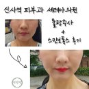 바른피부과의원 | 신사역 피부과 추천 세레아의원 물광주사+스킨보톡스 후기｜건조한 피부·잔주름 고민 상담부터 시술까지