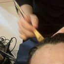 두피 탈모 아미치 0.3 수원점 이미지