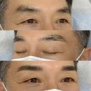 오늘은 | 남자 눈썹문신 잘하는 곳 - 남양주 &#39;오늘은 미쁨&#39; 후기