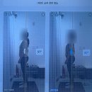 척추가 중심 | 수원체형관리 1회만에 달라지는 척추측만증 후기