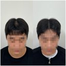 대전 도안동 둔산동 두피문신 잘하는곳, 도트바이림