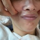 플로라뷰티 | 동탄피부관리 블링블링 물광케어 후기 플로라토탈뷰티