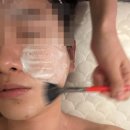 다온 | [중랑구여드름관리] 중랑구 망우 여드름관리 '다온미에스테틱' 후기