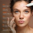 라시뎀 모공 트러블 뽀로롱 ac 스팟 세럼 써야하는 이유
