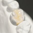 란치과기공소 이미지