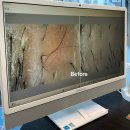 노블빌딩 | [부산] 동래두피관리 더노블 메디센터 부산두피관리 (예민두피관리 순서 및 후기)