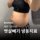 공지로 2L | [공지] 부천뱃살빼기 다이어트 + 부천 허벅지 람스 1년 후기 (복부 냉동치료, 고압 산소)