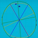 아이사랑두헬멧 대구센터 | 아기 단두 사두 두상교정 치료ㅣ대구 아이사랑두 헬멧 후기