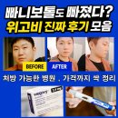오스본병원 | 위고비 처방 병원 어디? 가격, 효과, 부작용까지 한 번에 정리!