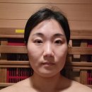 사라피부 | 천안쑥뜸관리 얼굴부종 때문에 시작한 신부동피부관리 후기