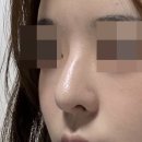 유노성형외과의원 네이버블로그
