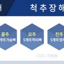후유 이미지