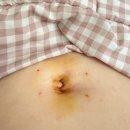 분당세계로약국 | 시험관시술/마리아(최화영)->분당제일여성병원(김현정)->차병원(김지혜)