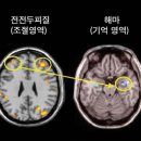 몸서리치는 기억으로부터의 자유 이미지