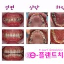 e-플랜트치과 이미지