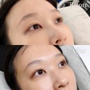 응암역2번출구 앞 (소공원 앞) | 응암역속눈썹펌 그린리래쉬룸 속눈썹펌 후기 (가격, 전후사진)