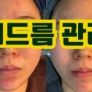 스킨테라피 이미지