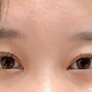 린지뷰티 이미지