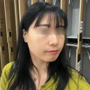 이층약국 | 울쎄라 하려다 포트라 리프팅 진행, 창원 성산구 상남동 피부과 추천 후기