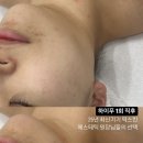 몬트부띠끄스킨