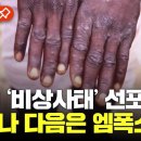 '비상사태' 선언한 세계보건기구…엠폭스는 지금도 빠르게 확산 중 이미지